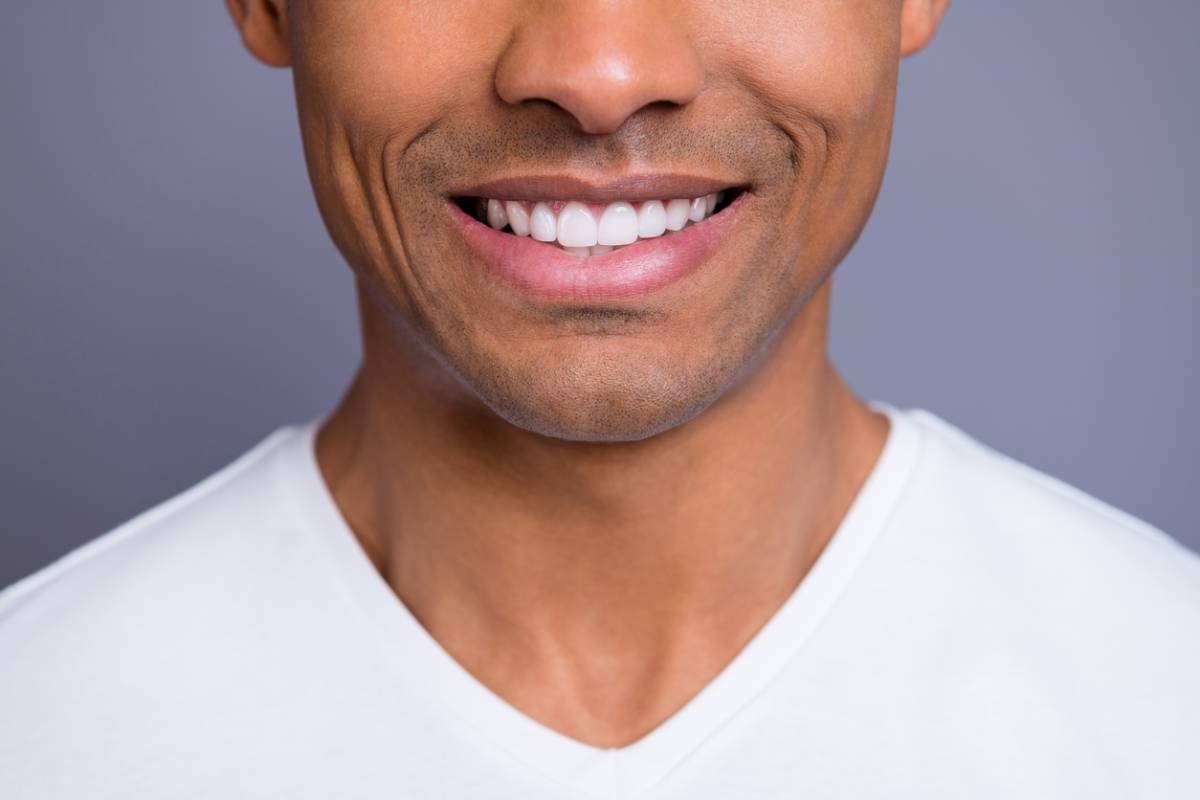 Man who has whiten tobacco stained teeth