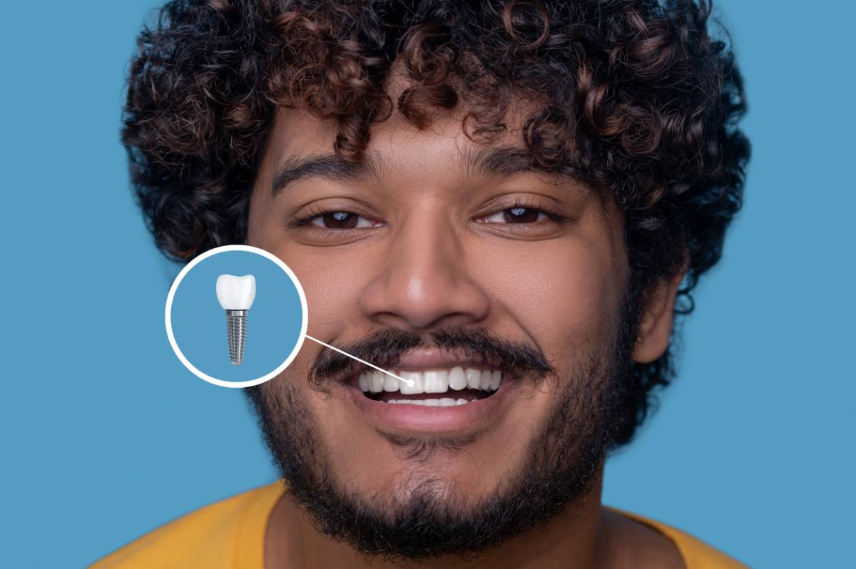 concept image of dental implats and smiling man