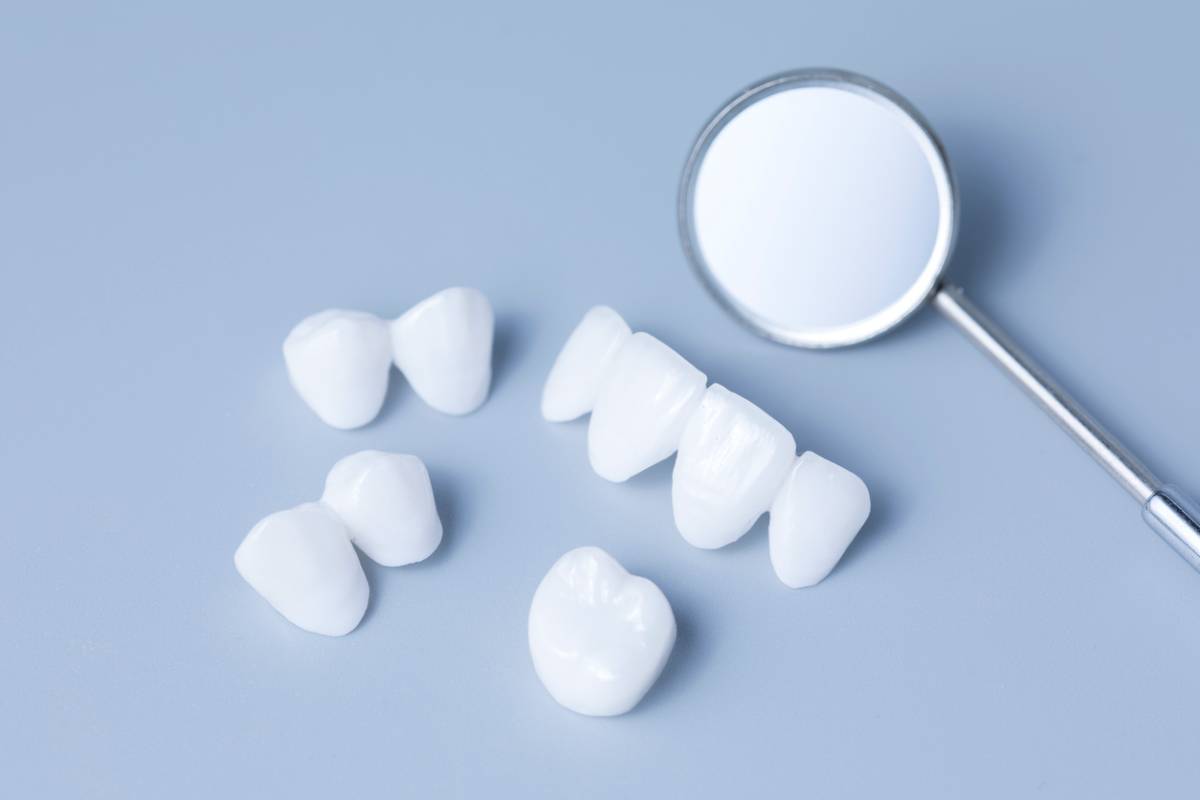 concept image of porcelain veneers