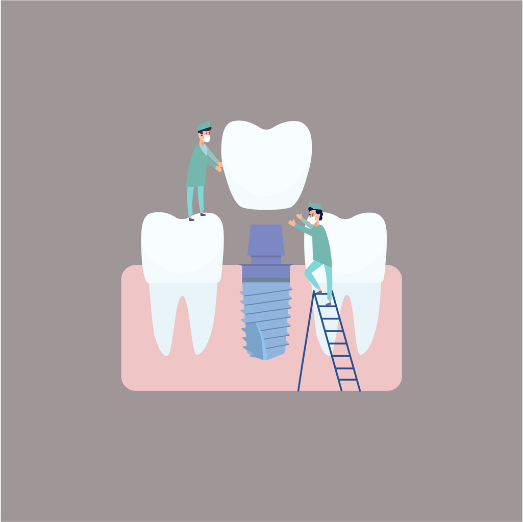 concept image of choosing right dentist for dental implants
