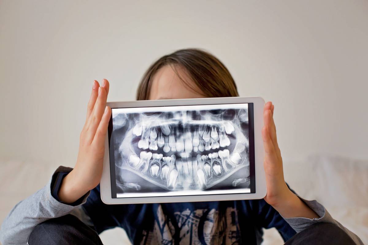 featured image for benefits of dental x-rays