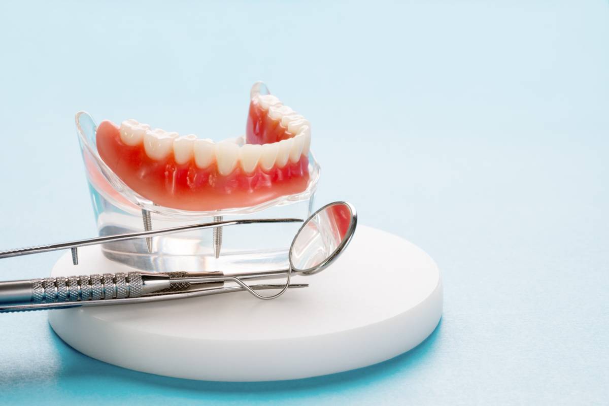 featured image for key advantages of implant dentures