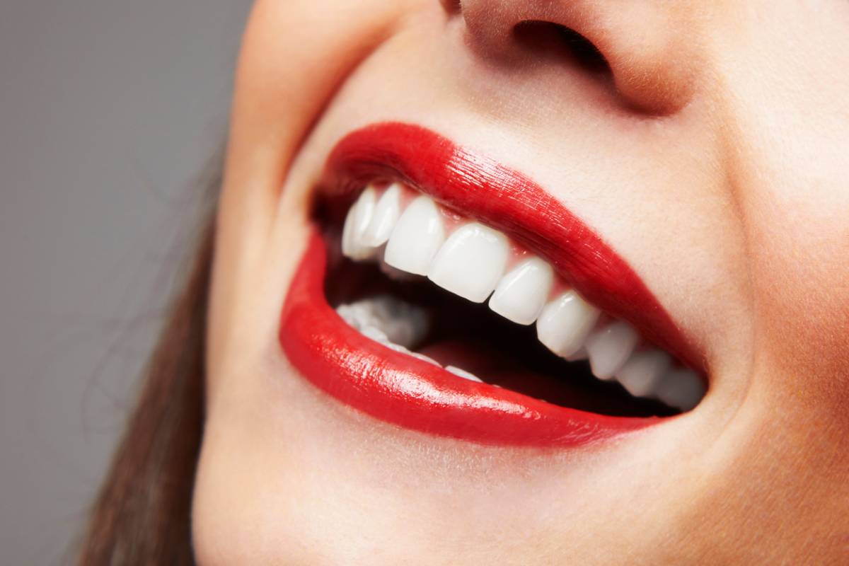 concept of smile after teeth whitening