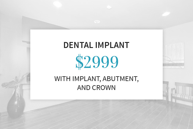 Image for Dental implant offer $2999 with implant, Abutment and Crown