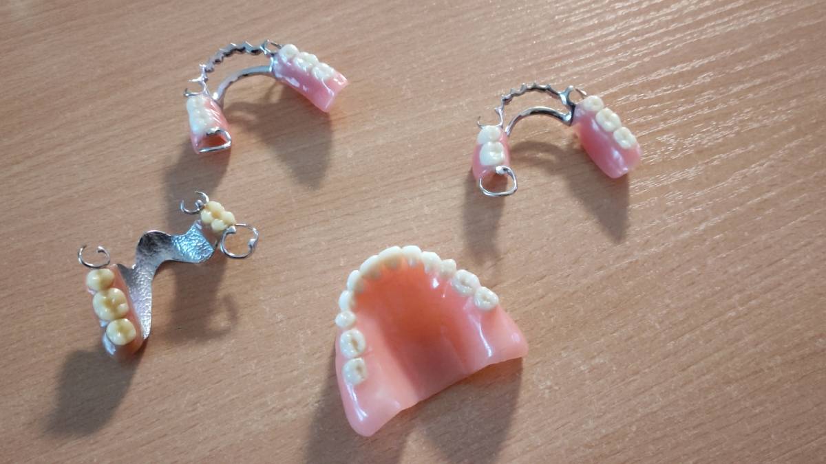 Dentures on the dentist's table.